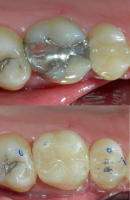 Los Angeles Cosmetic Dentist